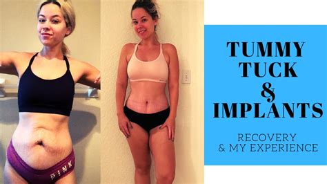 Tummy Tuck Recovery - Breast Lift and Implants - After Losing Almost ...