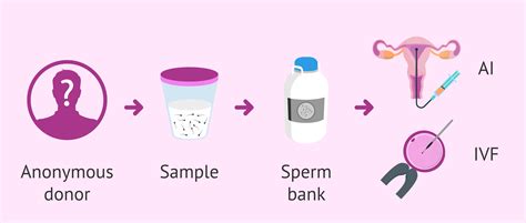 How is sperm donation explained step by step?