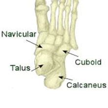 Midtarsal Joint Sprain foot pain explained | Sportsinjuryclinic.net