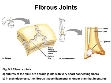 PPT - Joints Bone Connections PowerPoint Presentation - ID:176707