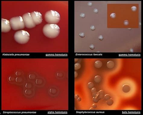 Blood Agar- Composition, Preparation, Uses and Pictures | Medical laboratory science, Medical ...