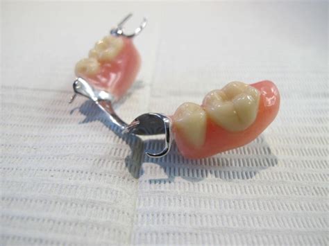 Partial Dentures in Windsor | Baker Lanoue Denture Clinic