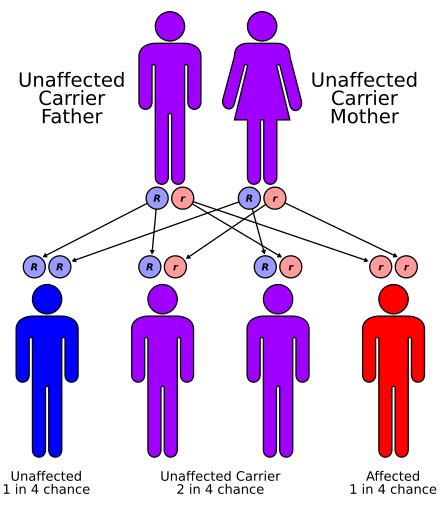 Cystinosis - Wikipedia