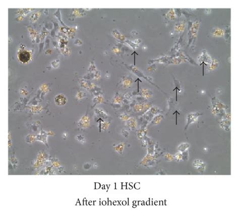 Optimization of the isolation of primary hepatic stellate cells (HSC)... | Download Scientific ...