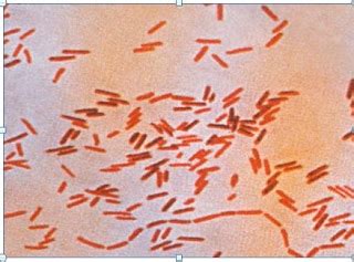 satu cinta :*: salmonella sp