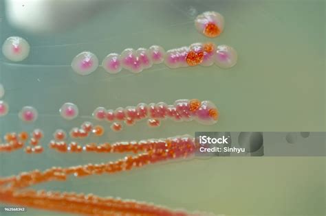 Serratia Marcescens Adalah Spesies Bakteri Gram Negatif Berbentuk Batang Dalam Keluarga ...