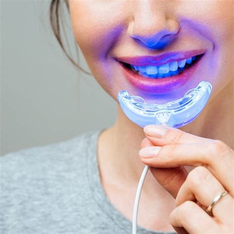 GLO Teeth Whitening Abingdon | Stained Teeth | Amburgey Dental