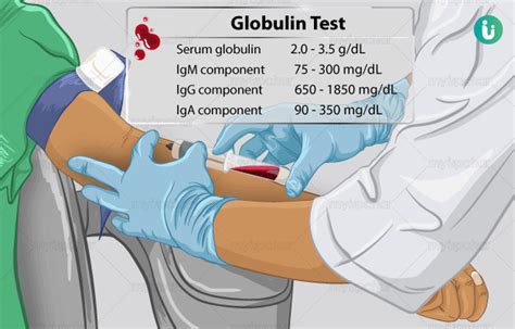 Globulin Test: Procedure, Purpose, Results, Normal range, Cost, Price ...