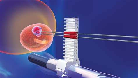 Targeted Prostate Biopsy - Olympic Diagnostic