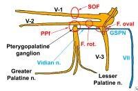 Nerve Pain: Vidian Nerve Pain