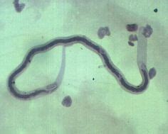 11 Loa loa ideas | eye worm, nematode, parasite