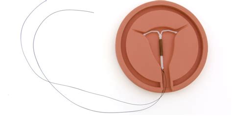 The coil (IUD): pros and cons