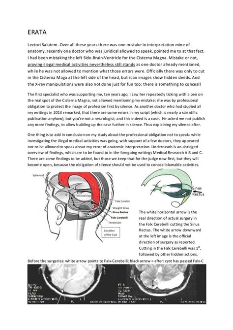 ERATA AND SUMMARY (ten years after starting investigation)