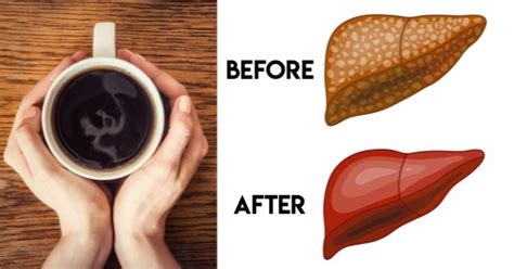 Mushroom Coffee Health Benefits: 6 Practical Uses For This Beverage