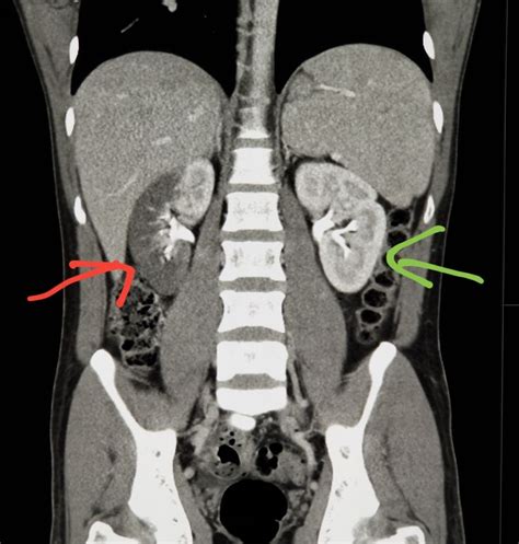 Pin on CT Scans