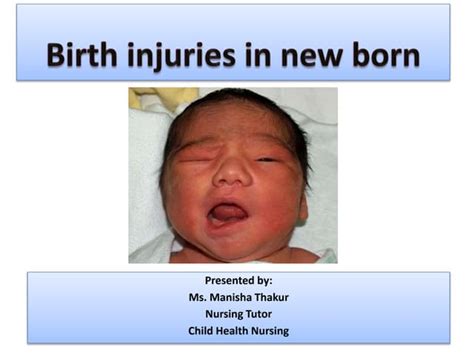 BIRTH INJURIES IN NEWBORN | PPT