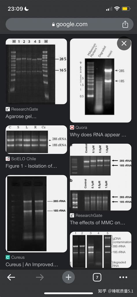 为什么28S rRNA的大小是4700bp，但是琼脂糖凝胶电泳的结果显示其大小约为2000bp? - 知乎