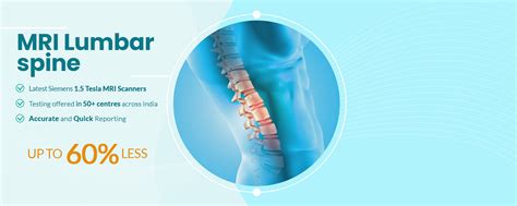 MRI Lumbar Spine Scan Price | MRI Lumbar Spine Scan starts at Rs.4500 - Aarthi Scan and Labs