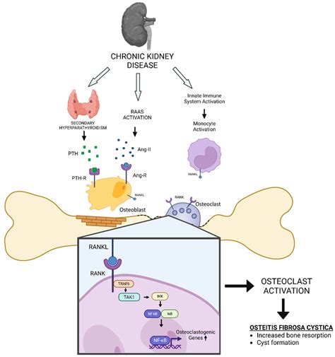 Schematic diagram of how CKD could induce Osteitis Fibrosa Cystica (OFC ...