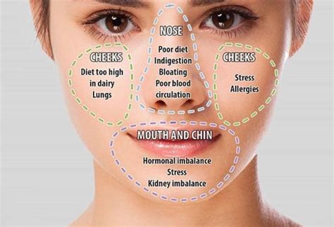 Chinese Face Mapping Skin Analysis - The WHOot | Face mapping, Health ...