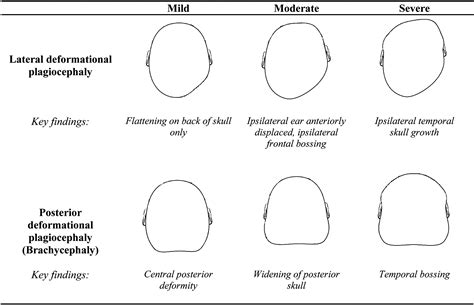 Evidence-Based Care of the Child With Deformational Plagiocephaly, Part ...