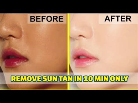 Get Rid of Tanning Skin | Simple Steps | Knowledge & Facts (Health) - YouTube