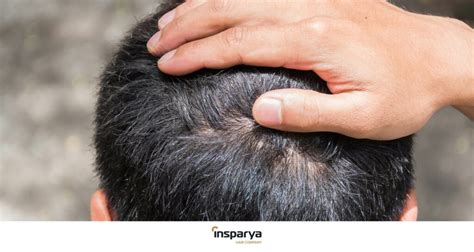 Itchy and painful irritated scalp - Solutions | Insparya Hair Clinic