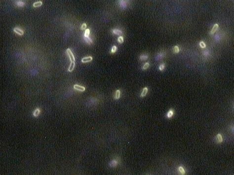 Dark Field Microscopy Bacteria