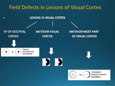 Visual Pathway Lesions VISUAL PATHWAY ANATOMY COMPONENTS OF