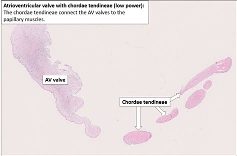 Atrioventricular Valve Histology