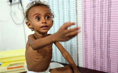 Some 85,000 children in Yemen may have died from hunger, charity finds