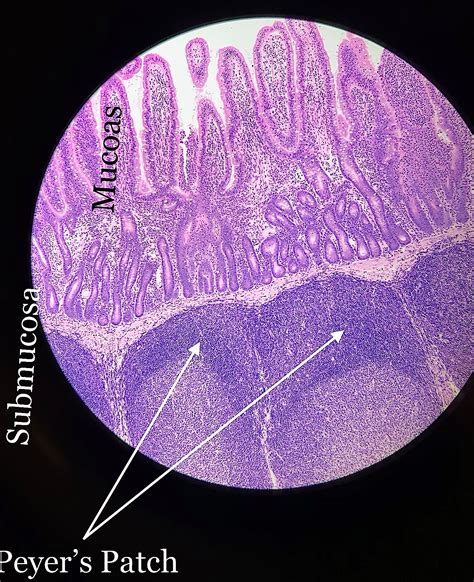 Peyer's Patch Histology.