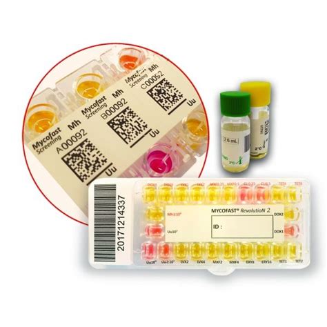 MYCOFAST® US For Mycoplasma And Ureaplasma Identification, 47% OFF