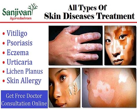 Skin Diseases Ayurvedic Treatment in India ~ Sanjivani ayurvedashram