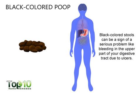 What Your Poop Says about Your Health | Top 10 Home Remedies