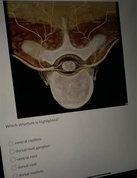 Solved Which structure is highlighted? ventral rootlets | Chegg.com