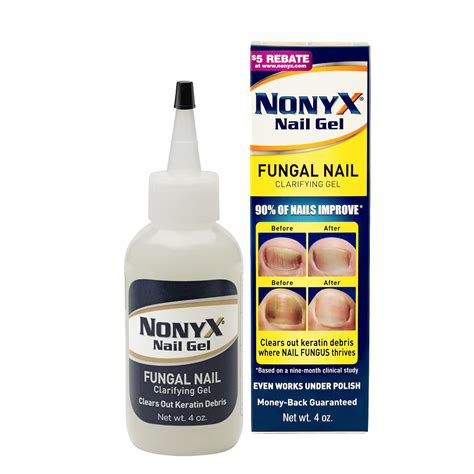 Buy NONYX Fungal Nail Clarifying Gel, a Toenail Fungus that Cleans out Keratin Debris where Nail ...