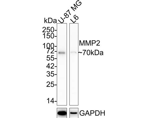 MMP-2 Recombinant Rabbit Monoclonal Antibody [SI15-04] (ET1606-4) – HUABIO