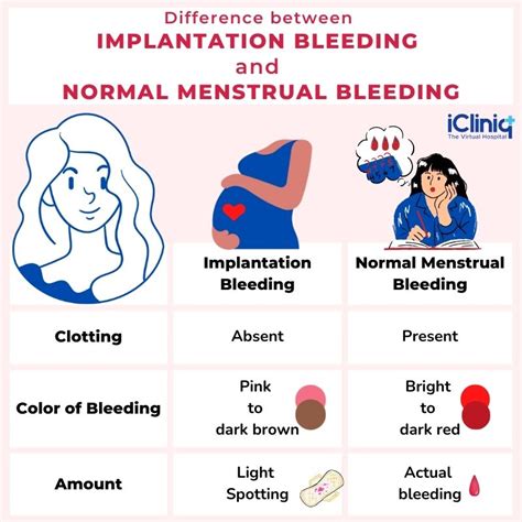 How To Tell The Difference Between Implantation Bleeding And Your Period – NBKomputer