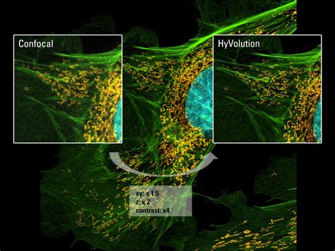 Confocal Laser Scanning Microscopy Of N Benthamiana Leaves Showing - Riset