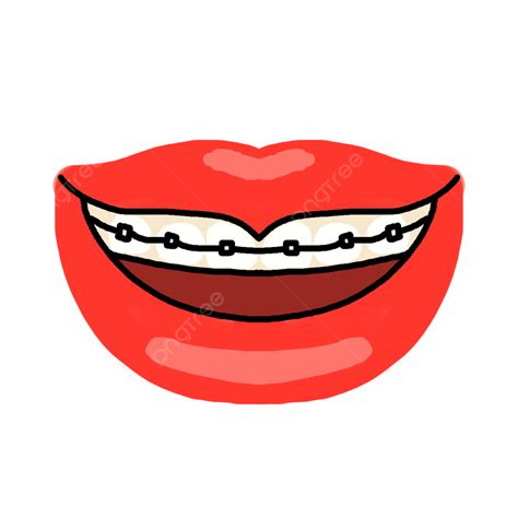 Plump Lip Braces, Plump Lips, Braces, Woman PNG Transparent Clipart Image and PSD File for Free ...