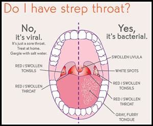 Student Health and Wellness / Strep Infections