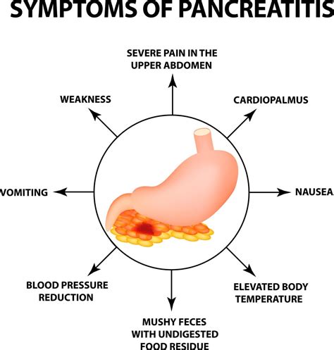 Pancreatitis and Alcohol - Rehab Guide