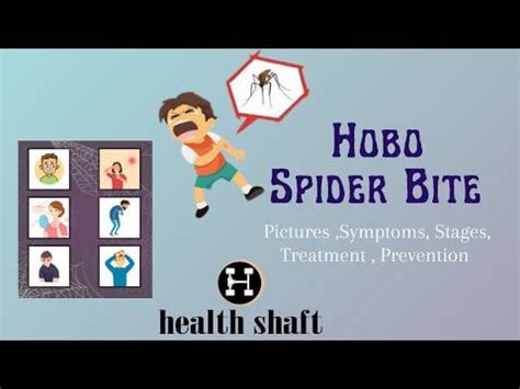 Hobo Spider Bite : HealthyGuide