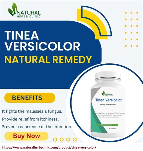 Natural Remedies for Tinea Versicolor by msemmajohn - Issuu