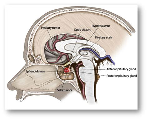 Sella Turcica Anatomy