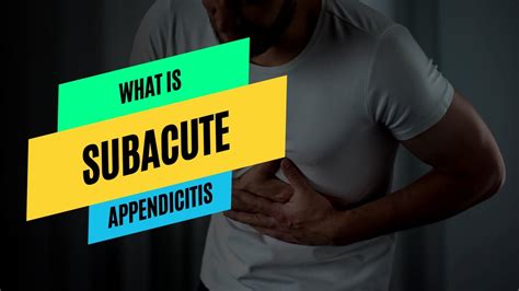 What is Subacute Appendicitis Symptoms, Diagnosis and Treatment - YouTube