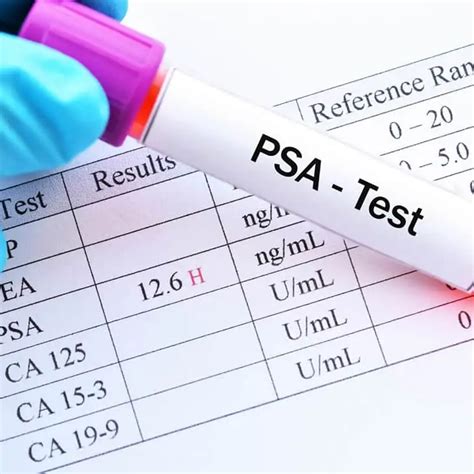 High PSA Level: Causes, Symptoms, Treatment Options