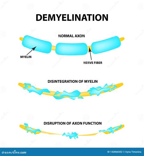 Neuron Myelin Sheath Vector Illustration | CartoonDealer.com #93427924