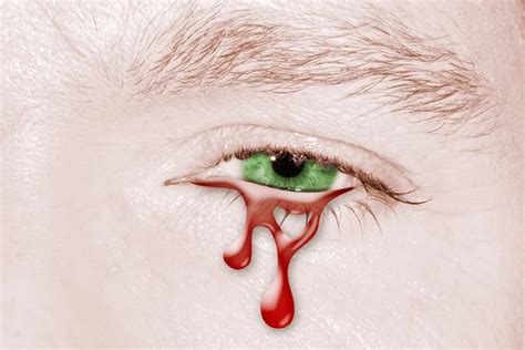 Italy bloody crying eye — Stock Photo © bennymarty #232563242